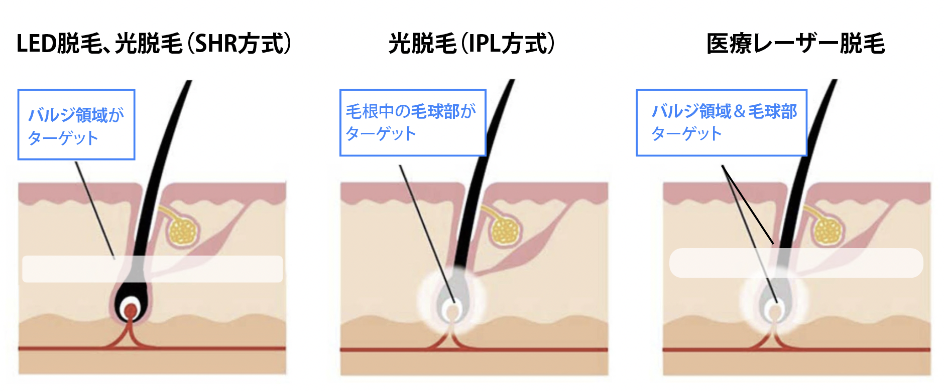 どれくらいの脱毛が正常ですか