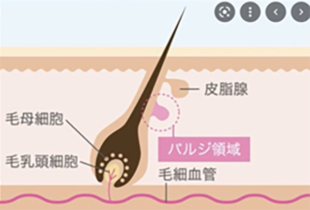 脱毛の種類はどれがいい？IPLやSHRなどの違いを知っていますか 